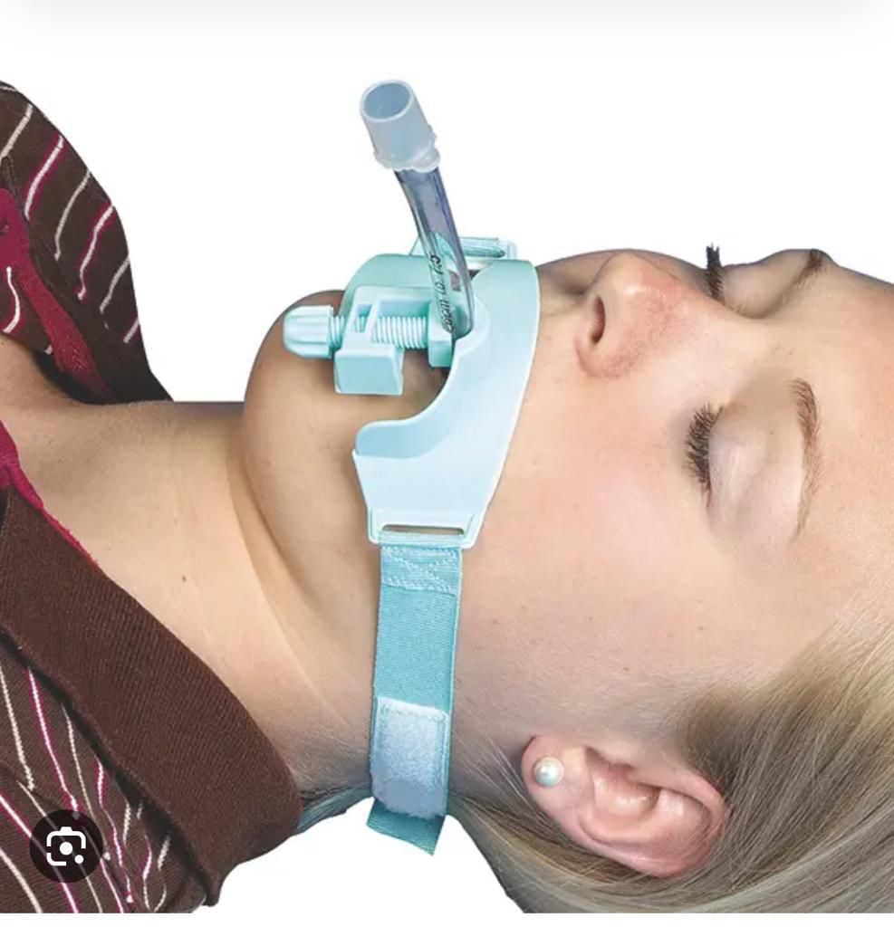 securement device for an Endotracheal Tube (ETT)