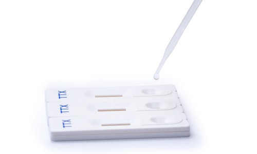 The Bovine Tuberculosis Antibody Rapid Test Kit